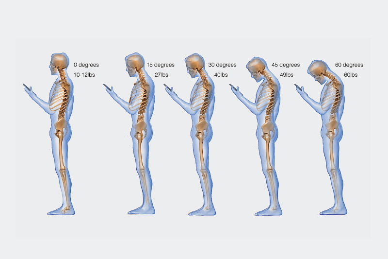 Come l’utilizzo degli Smartphone condiziona la nostra postura