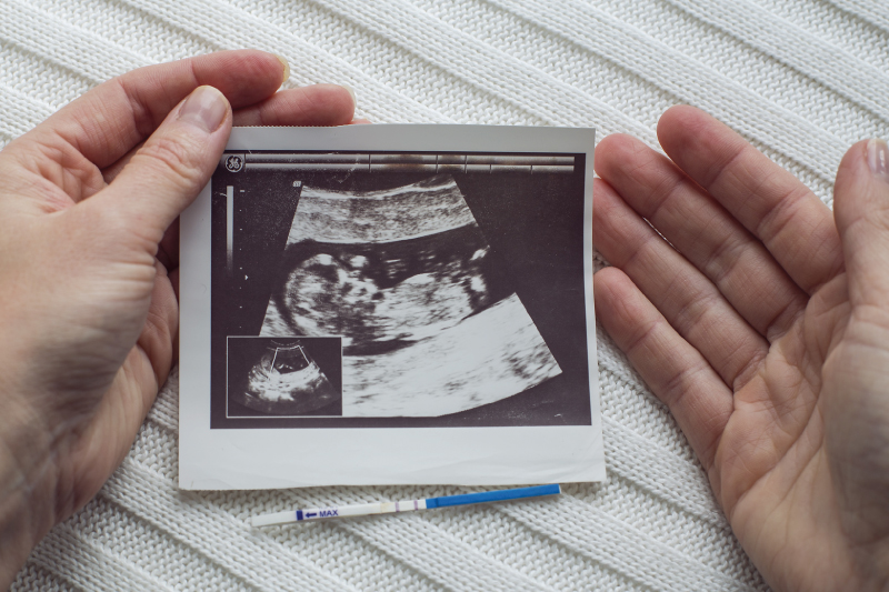 ecografie si eseguono durante i primi tre mesi di gravidanza.